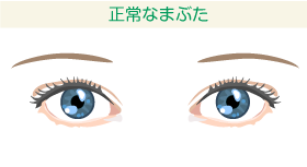 正常なまぶた